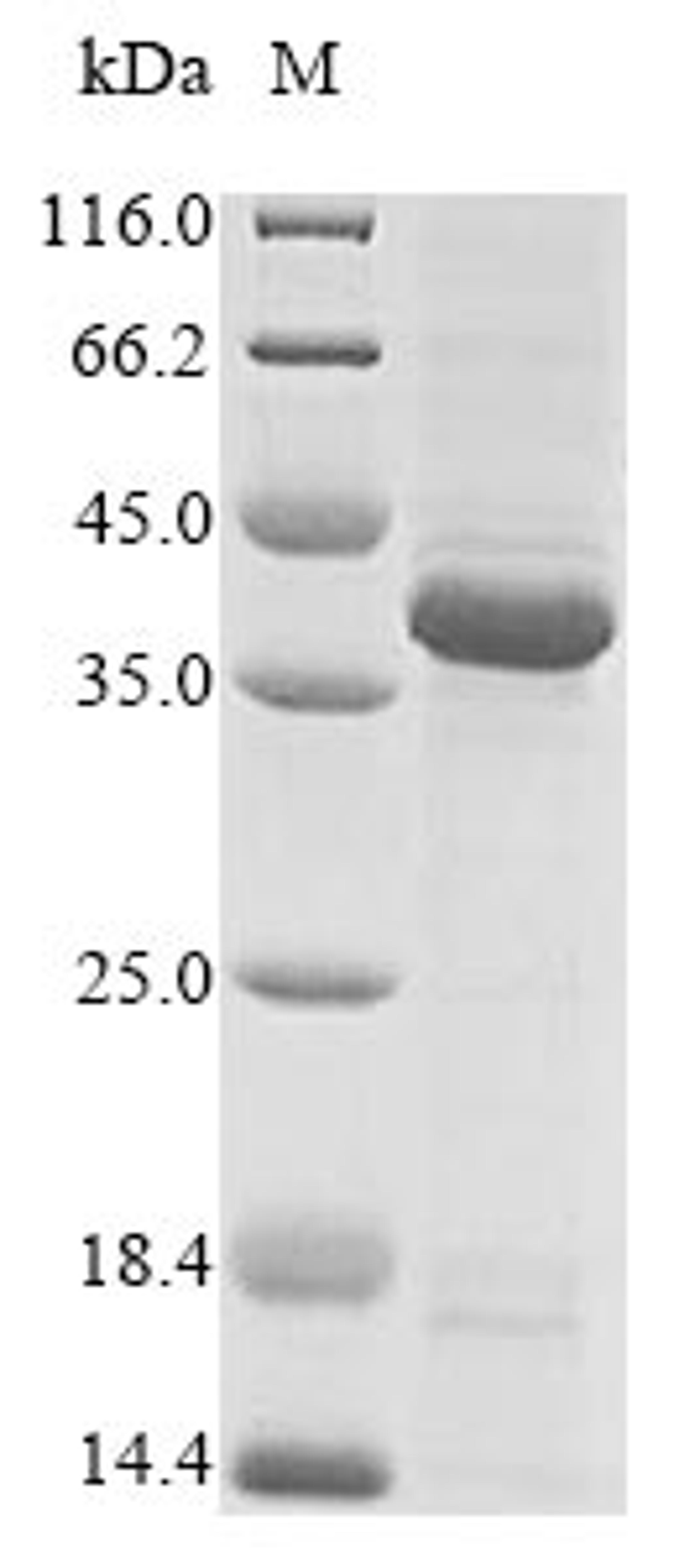 (Tris-Glycine gel) Discontinuous SDS-PAGE (reduced) with 5% enrichment gel and 15% separation gel.