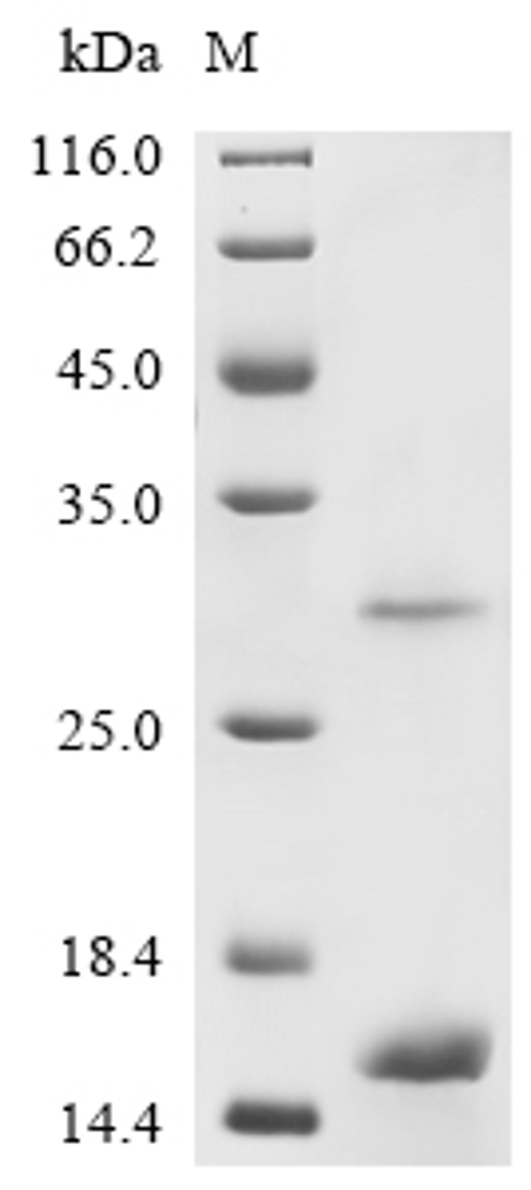 (Tris-Glycine gel) Discontinuous SDS-PAGE (reduced) with 5% enrichment gel and 15% separation gel.
