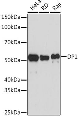 Western blot - DP1 Rabbit mAb (A5214)