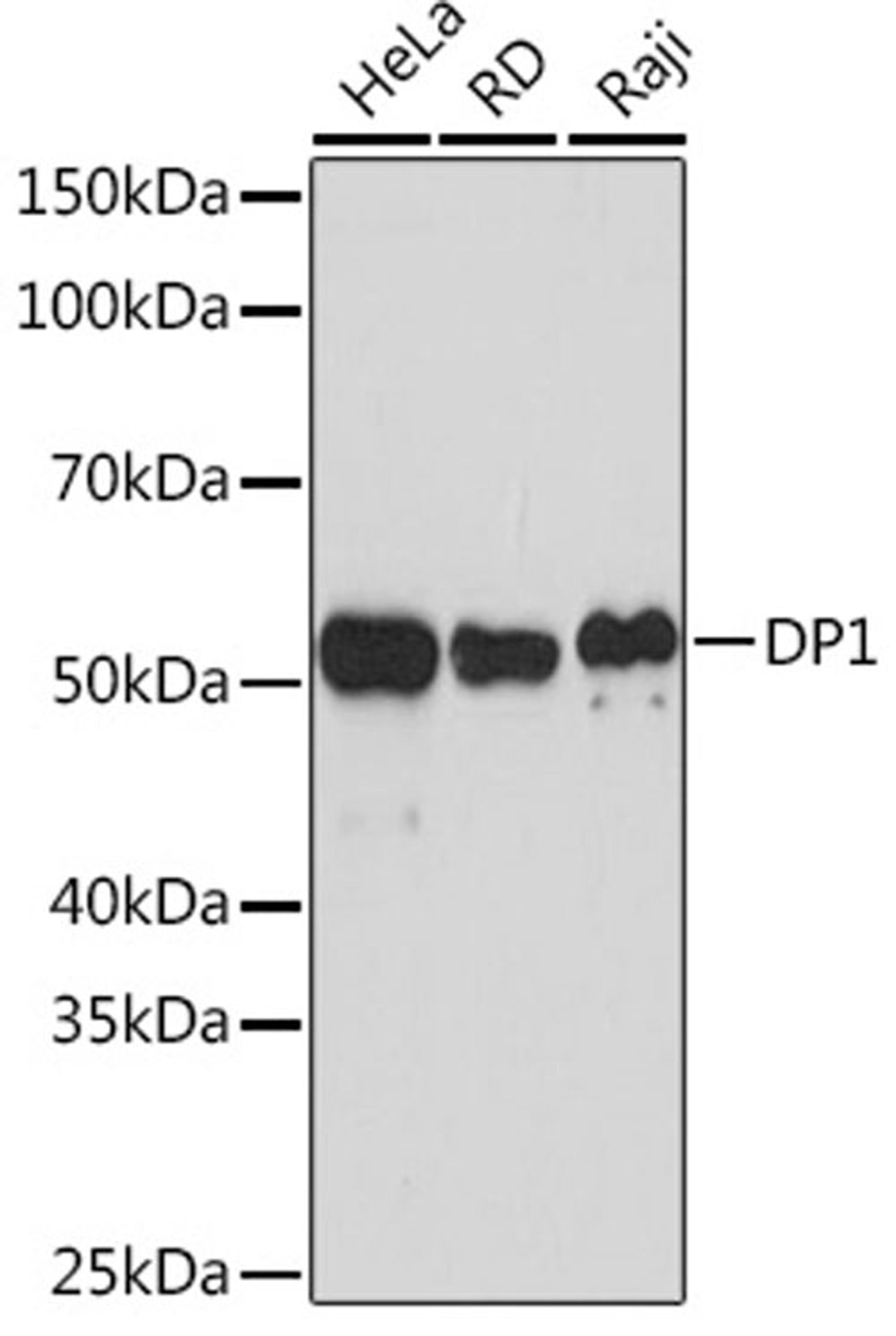 Western blot - DP1 Rabbit mAb (A5214)