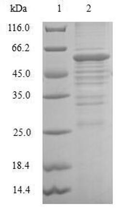 (Tris-Glycine gel) Discontinuous SDS-PAGE (reduced) with 5% enrichment gel and 15% separation gel.