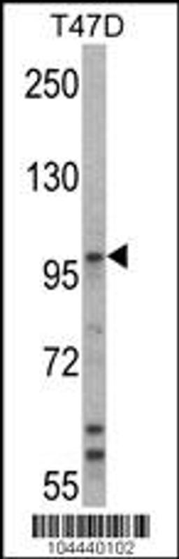 Western blot analysis of UBE3A Antibody in T47D cell line lysates (35ug/lane).