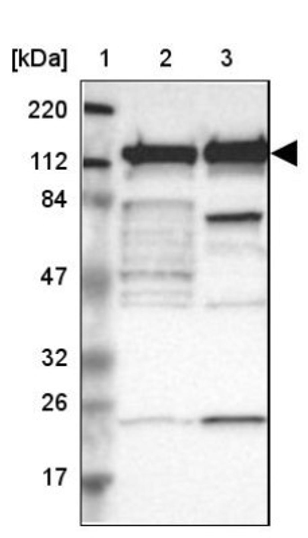 Western Blot: PPFIBP1 Antibody [NBP1-83192] - Lane 1: Marker [kDa] 220, 112, 84, 47, 32, 26, 17<br/>Lane 2: Human cell line RT-4<br/>Lane 3: Human cell line U-251MG sp