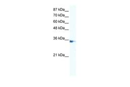 Antibody used in WB on Human Jurkat 5.0 ug/ml.