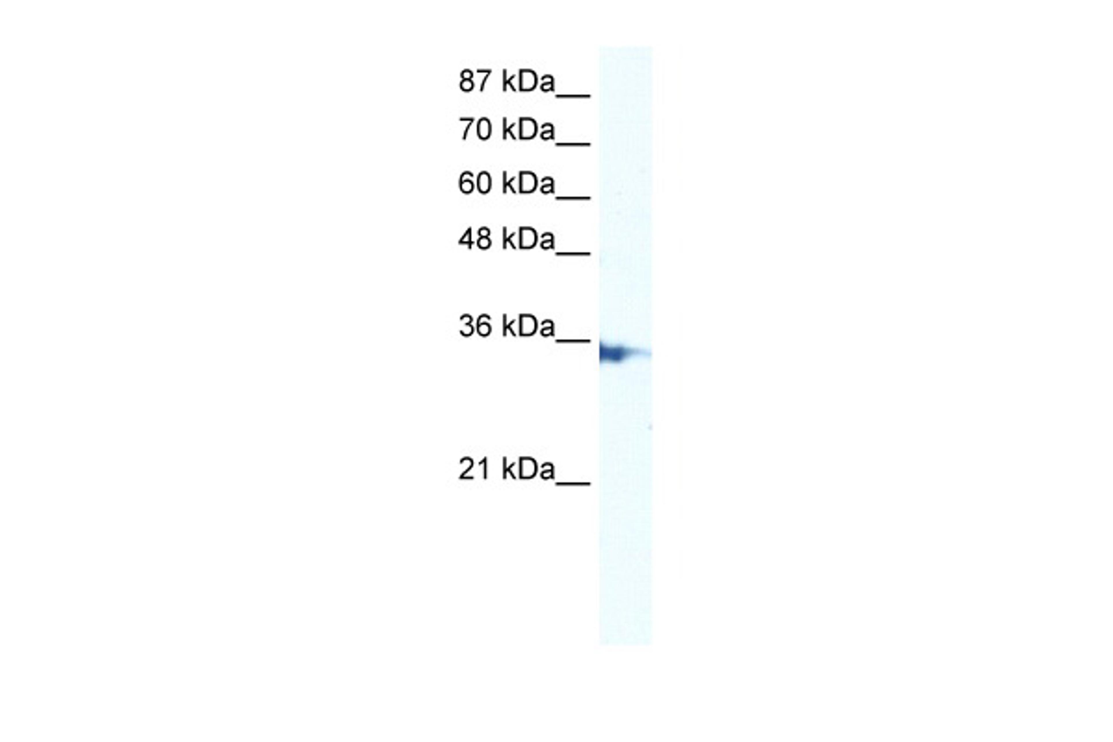 Antibody used in WB on Human Jurkat 5.0 ug/ml.