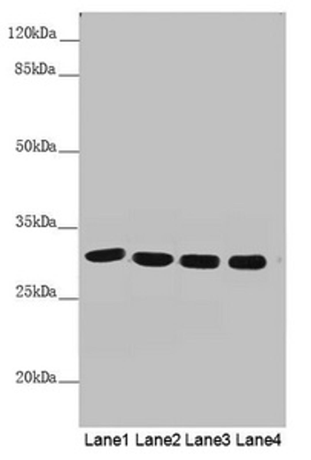 Western blot. All lanes: MTX2 antibody at 4.53 ug/ml. Lane 1: Mouse heart tissue. Lane 2: Mouse kidney tissue. Lane 3: Jurkat whole cell lysate. Lane 4: Mouse liver tissue. Secondary. Goat polyclonal to rabbit IgG at 1/10000 dilution. Predicted band size: 30, 29 kDa. Observed band size: 30 kDa.
