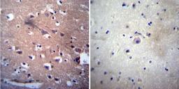 Immunohistochemistry-Paraffin: Acetylcholinesterase/ACHE Antibody (HR2) [NB300-528] - Both normal and cancer biopsies of deparaffinized human Brain tissue.