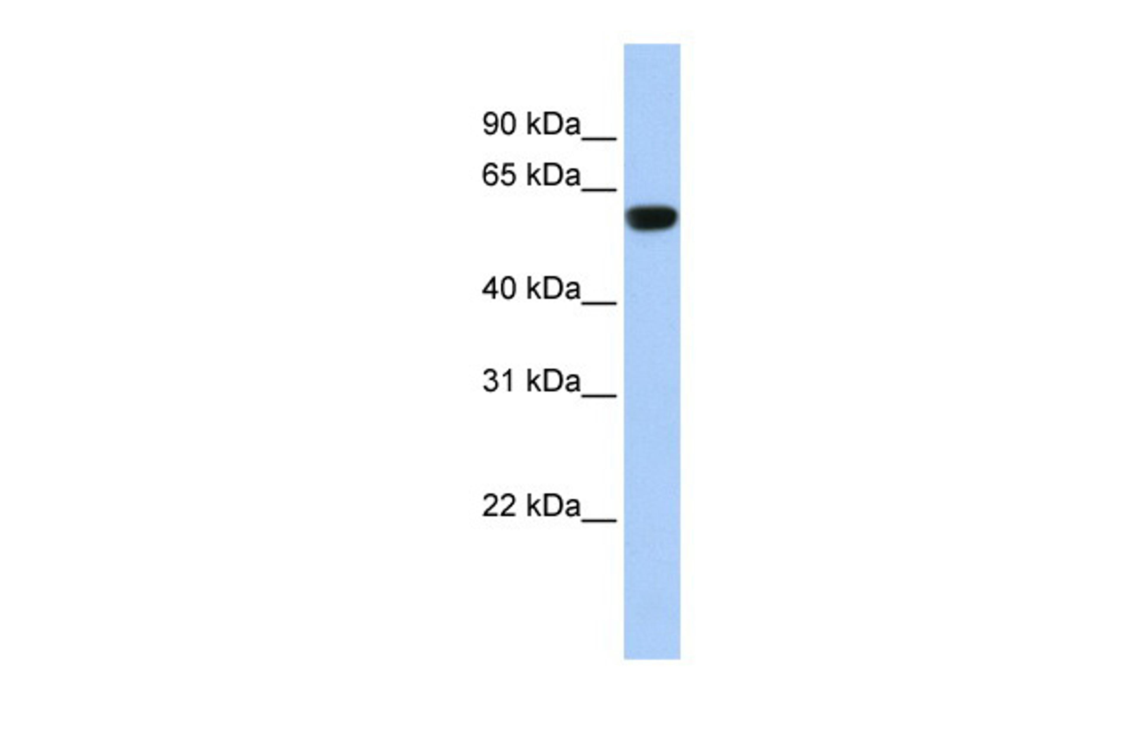 Antibody used in WB on Human Muscle at 0.2-1 ug/ml.