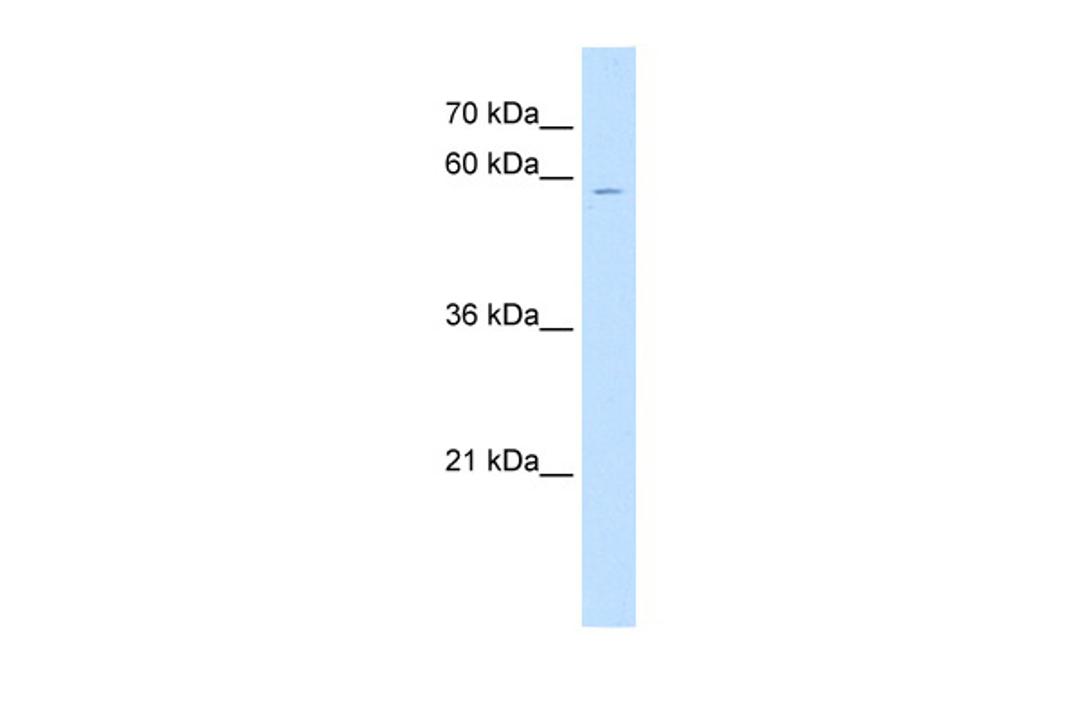 Antibody used in WB on Human Jurkat 0.2-1 ug/ml.