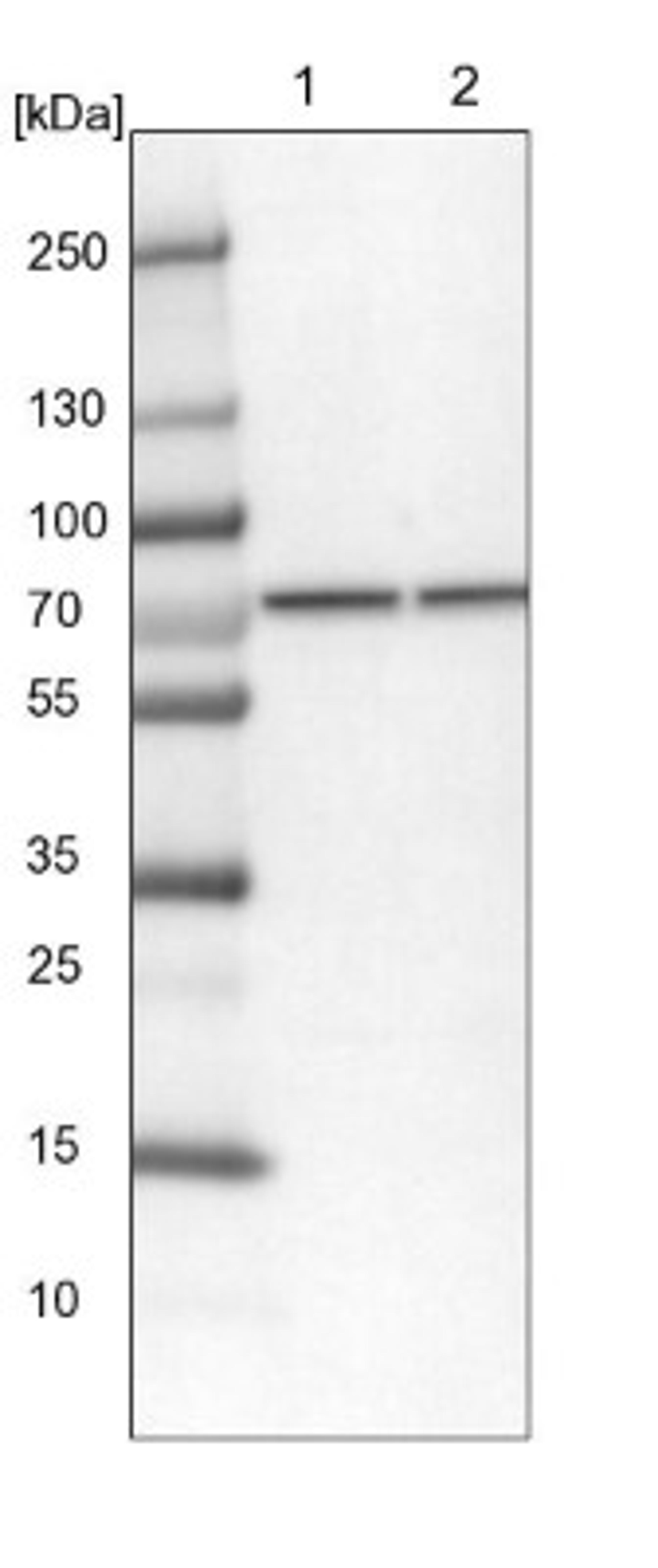 Western Blot: CCDC112 Antibody [NBP2-14442] - Lane 1: NIH-3T3 cell lysate (Mouse embryonic fibroblast cells)<br/>Lane 2: NBT-II cell lysate (Rat Wistar bladder tumour cells)