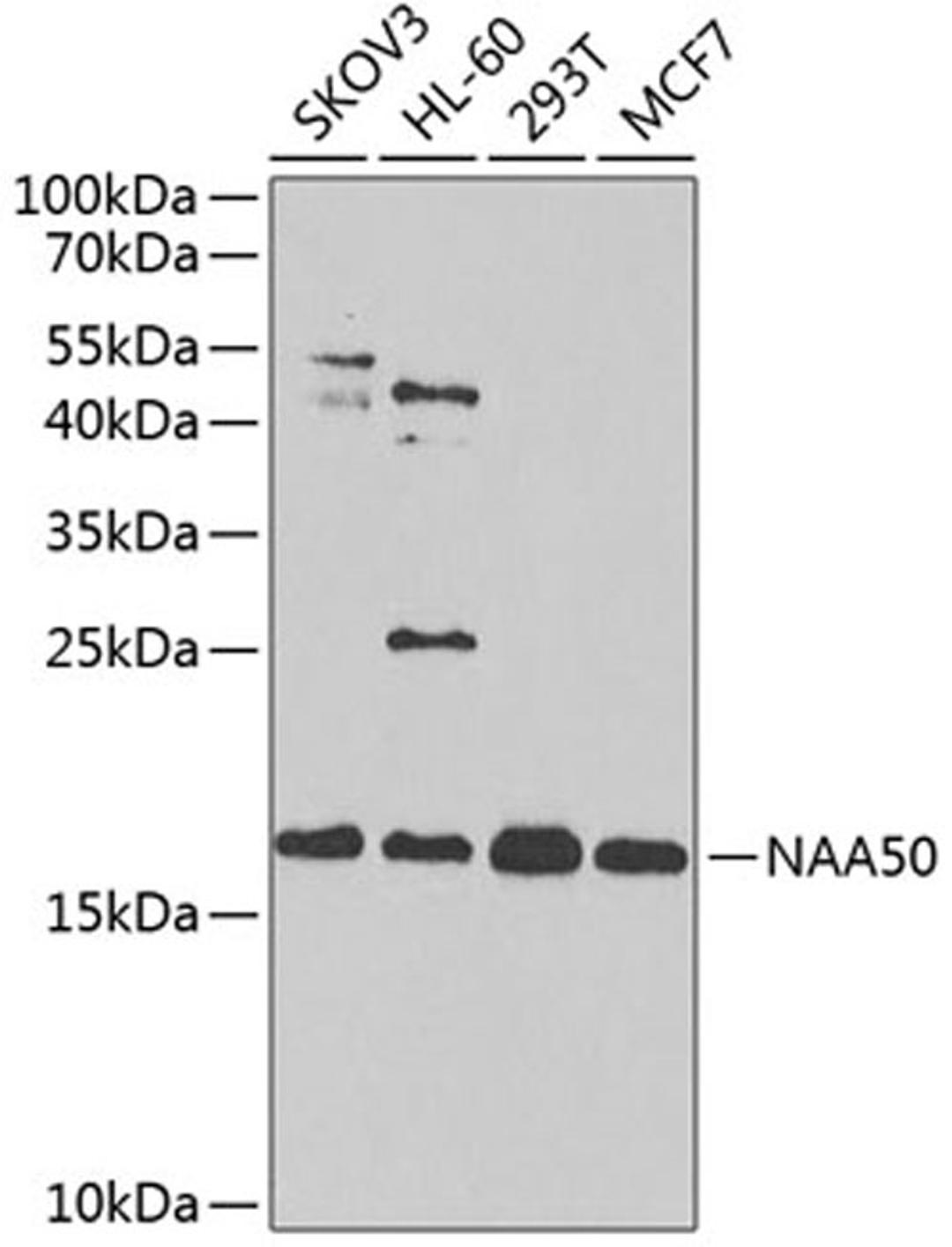 Western blot - NAA50 antibody (A4996)