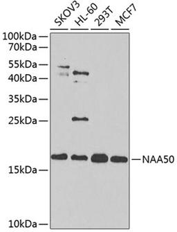 Western blot - NAA50 antibody (A4996)