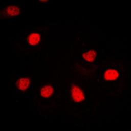 Immunofluorescense analysis of Jurkat cells using hnRNP G antibody