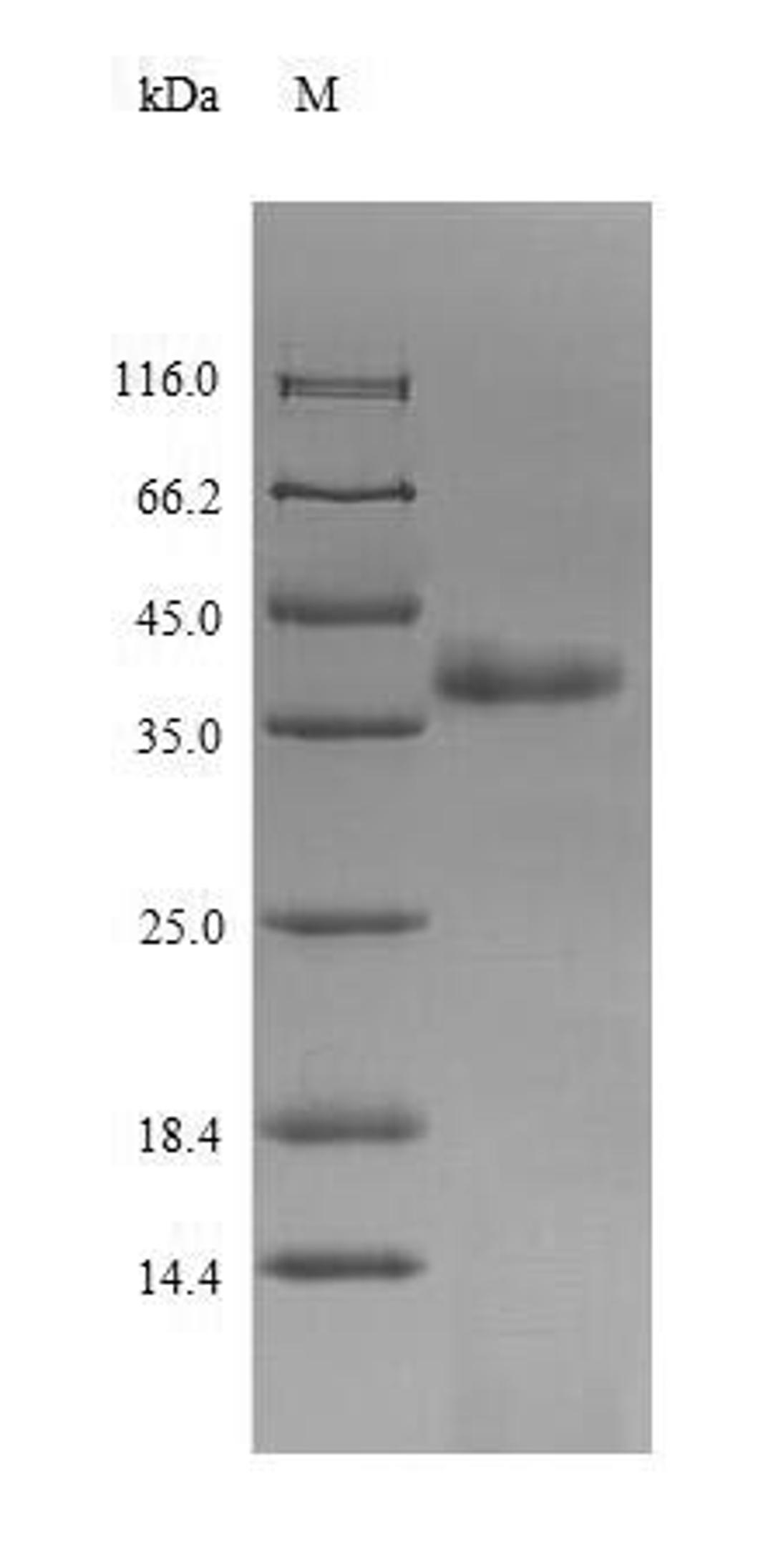 (Tris-Glycine gel) Discontinuous SDS-PAGE (reduced) with 5% enrichment gel and 15% separation gel.
