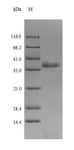 (Tris-Glycine gel) Discontinuous SDS-PAGE (reduced) with 5% enrichment gel and 15% separation gel.