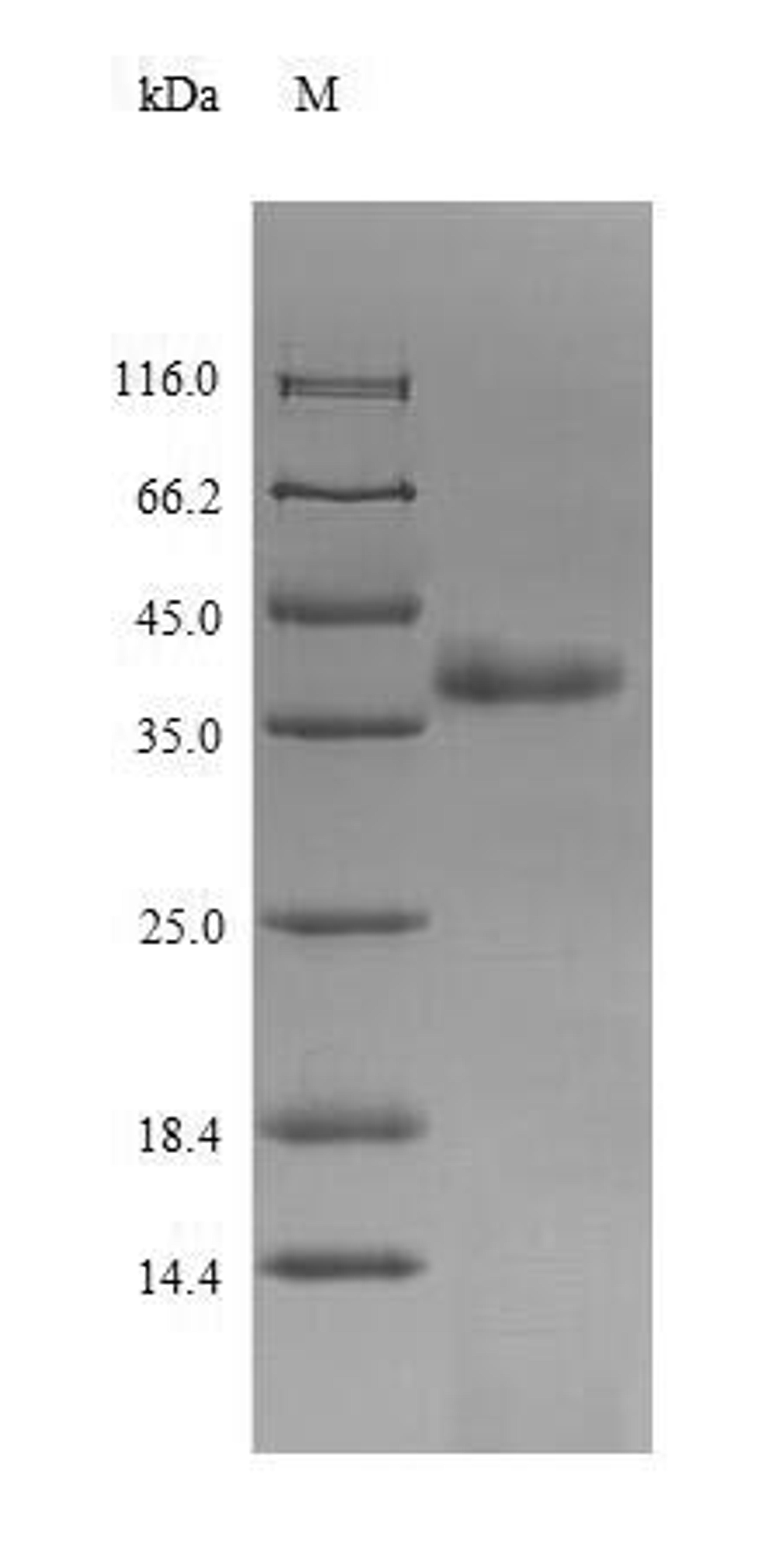 (Tris-Glycine gel) Discontinuous SDS-PAGE (reduced) with 5% enrichment gel and 15% separation gel.
