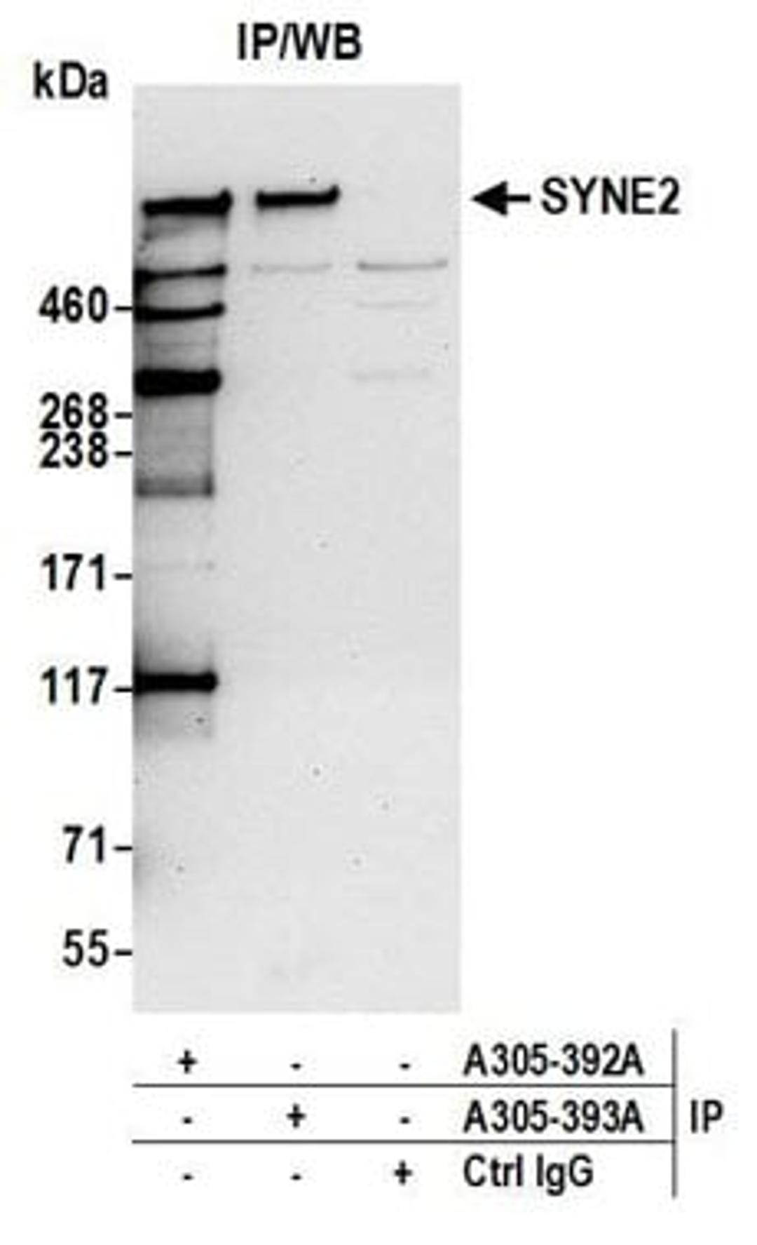 Detection of human SYNE2 by western blot of immunoprecipitates.