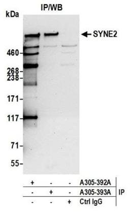 Detection of human SYNE2 by western blot of immunoprecipitates.