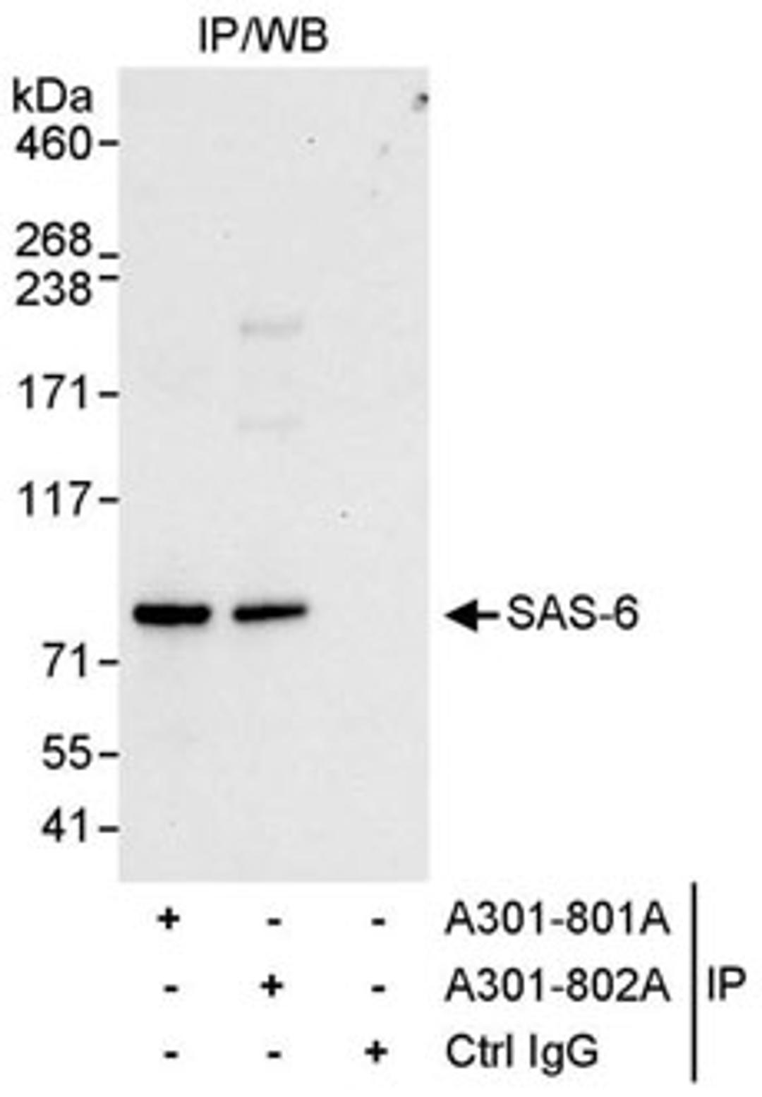 Detection of human SAS-6 by western blot of immunoprecipitates.