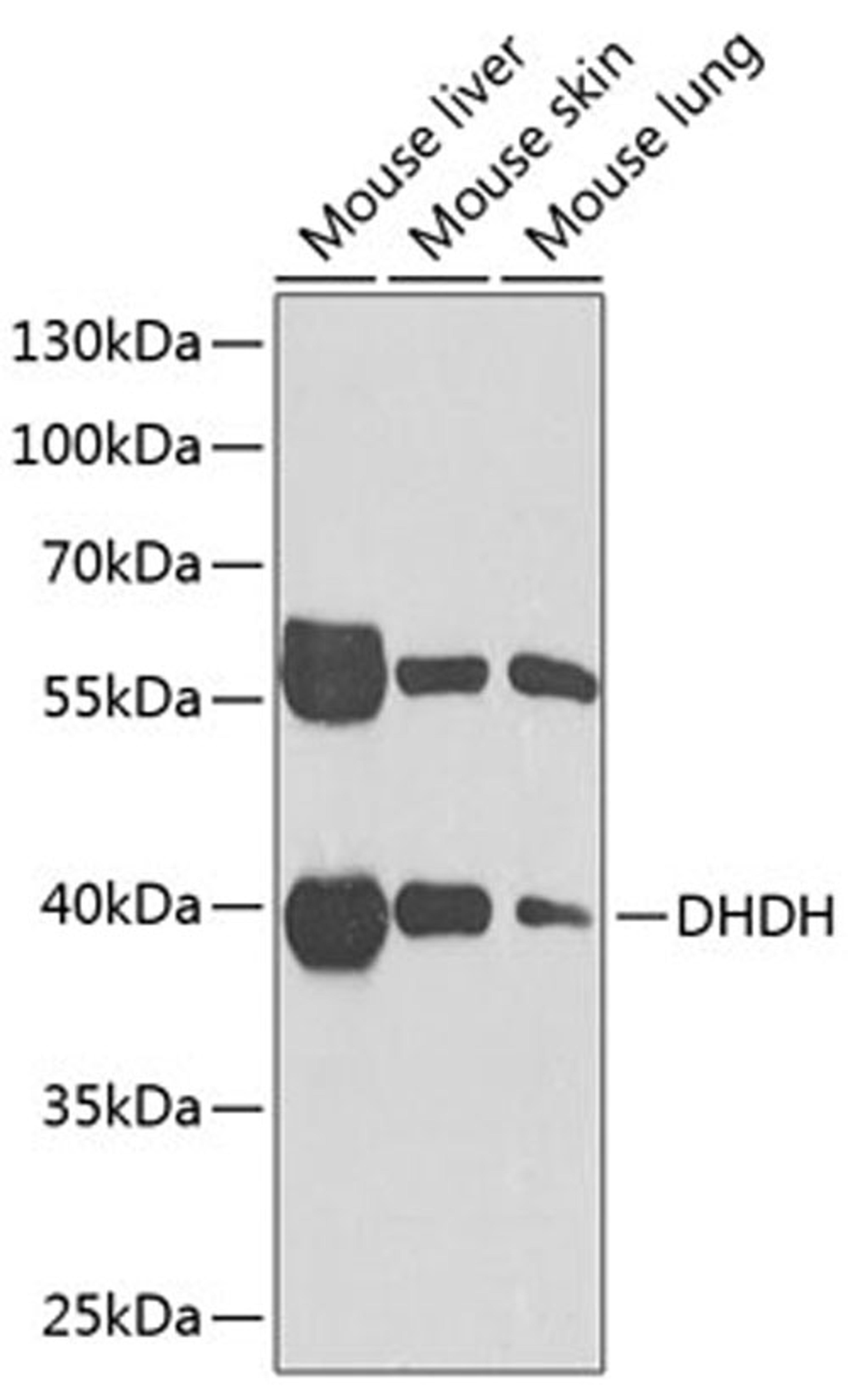 Western blot - DHDH Antibody (A6577)