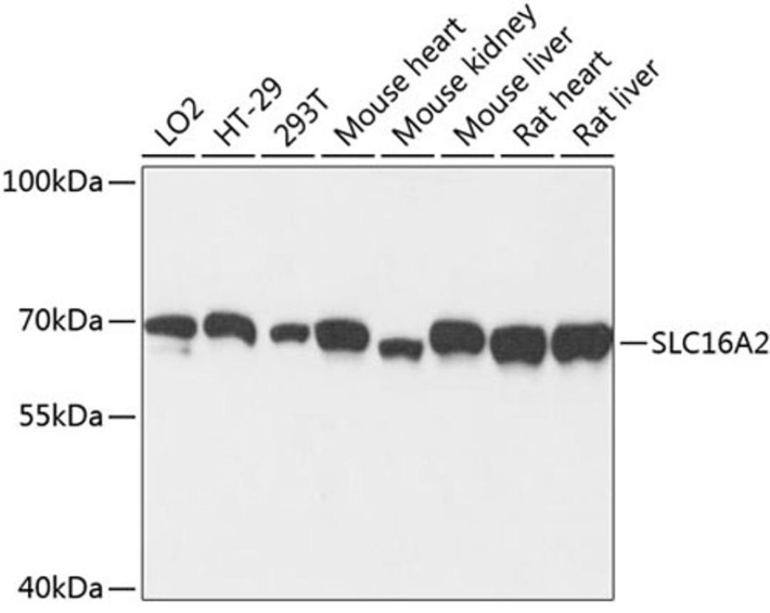 Western blot - SLC16A2 antibody (A3636)