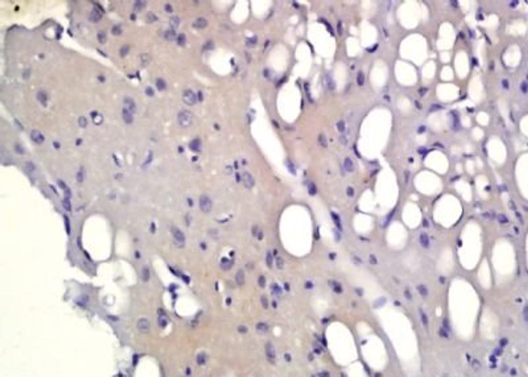 Immunohistochemical analysis of formalin-fixed paraffin embedded rat brain tissue using PHOX2B antibody (dilution at 1:200)