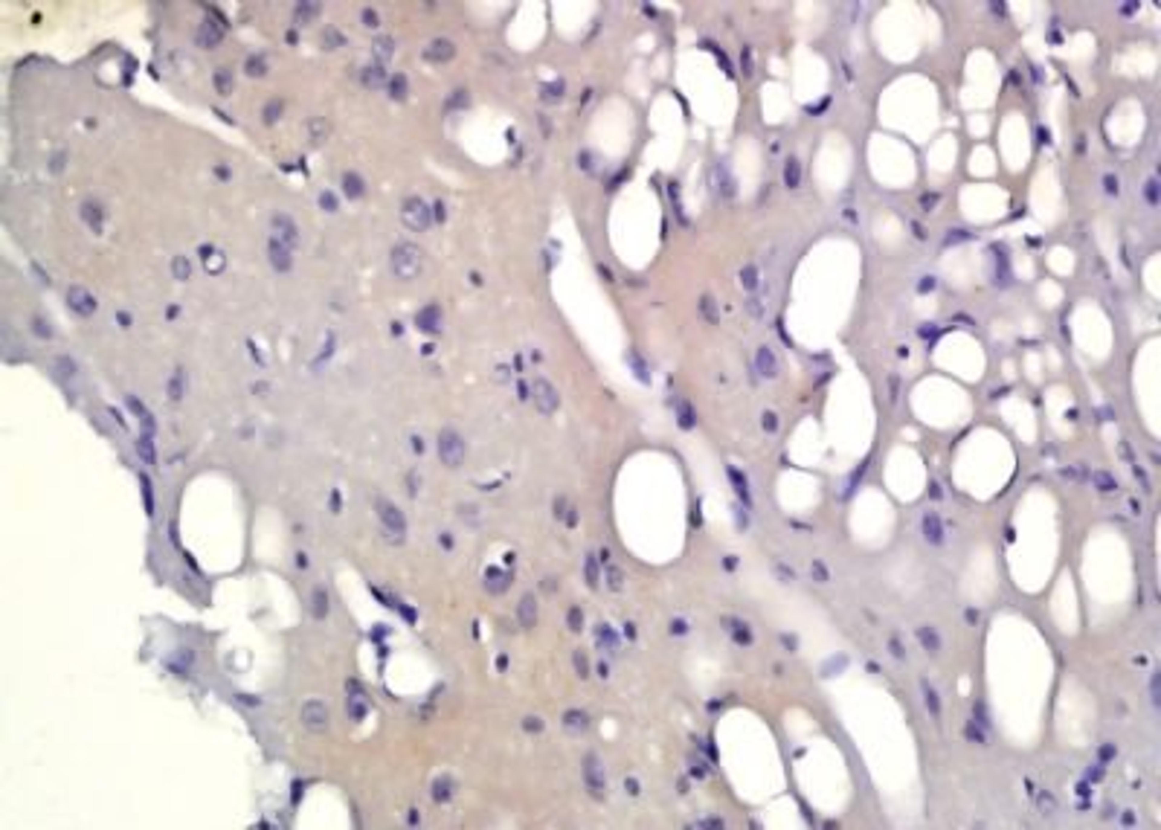 Immunohistochemical analysis of formalin-fixed paraffin embedded rat brain tissue using PHOX2B antibody (dilution at 1:200)