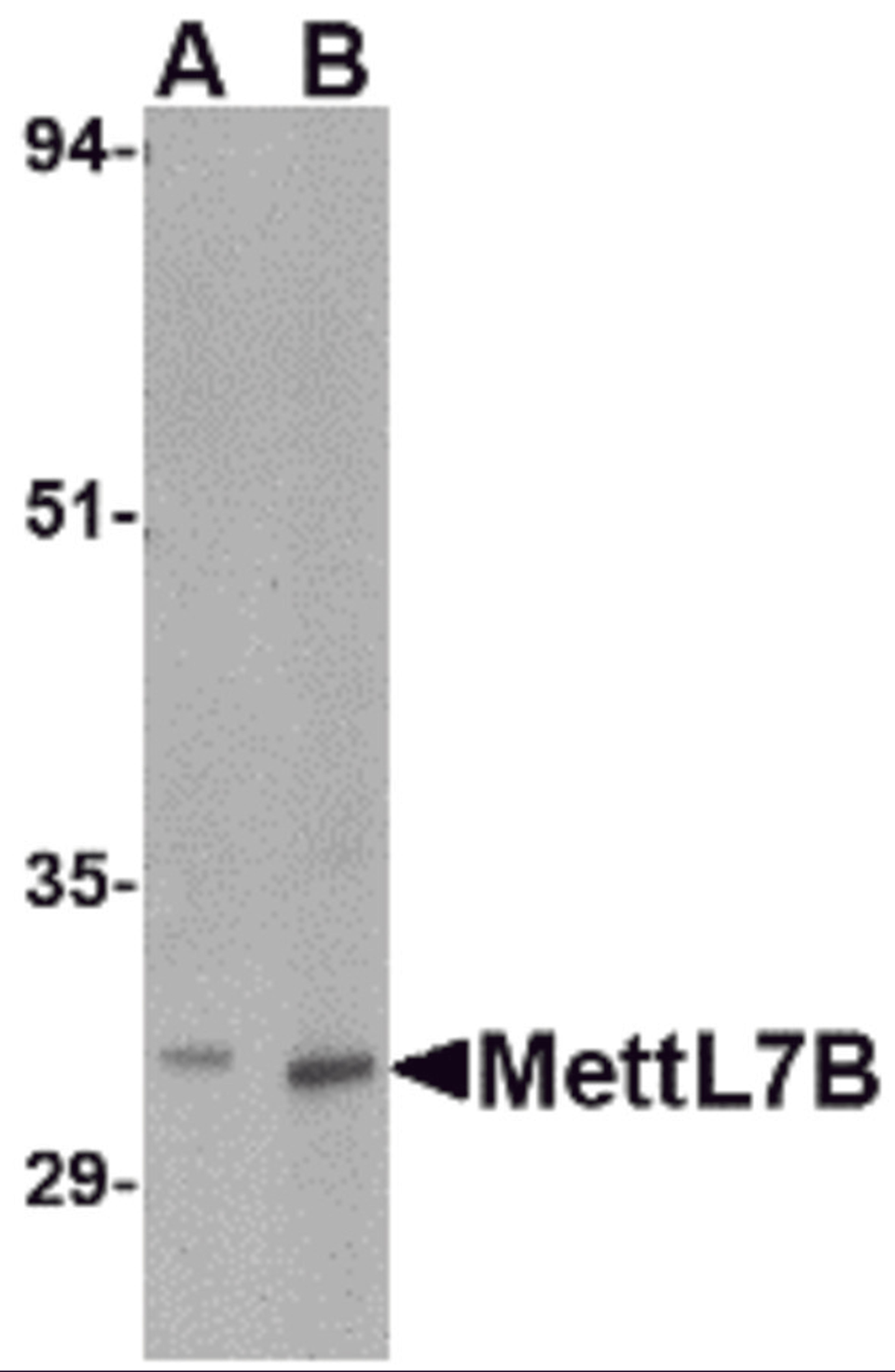 Western blot analysis of MettL7B in rat spleen tissue lysate with MettL7B antibody at (A) 2 and (B) 4 μg/mL.