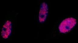 Immunocytochemistry/Immunofluorescence: SMC1 [p Ser966] Antibody [NB100-206] - Neocarzinostatin treated asynchronous HeLa cells.