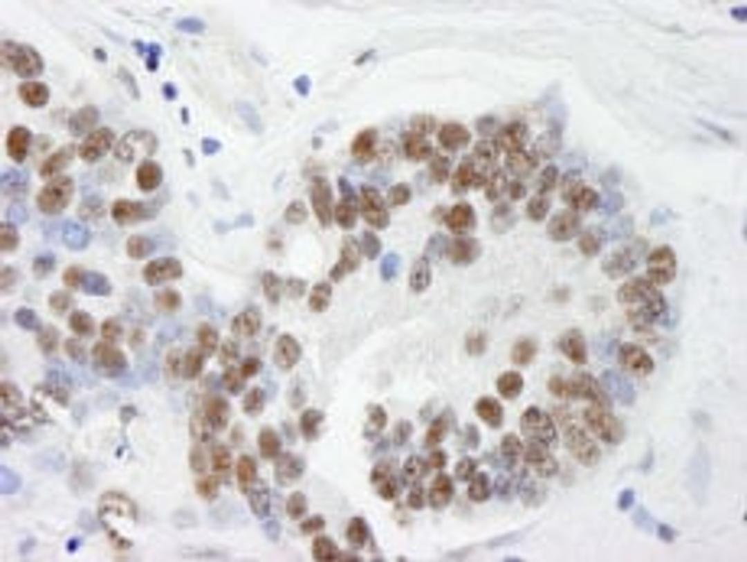 Detection of human THRAP3/TRAP150 by immunohistochemistry.