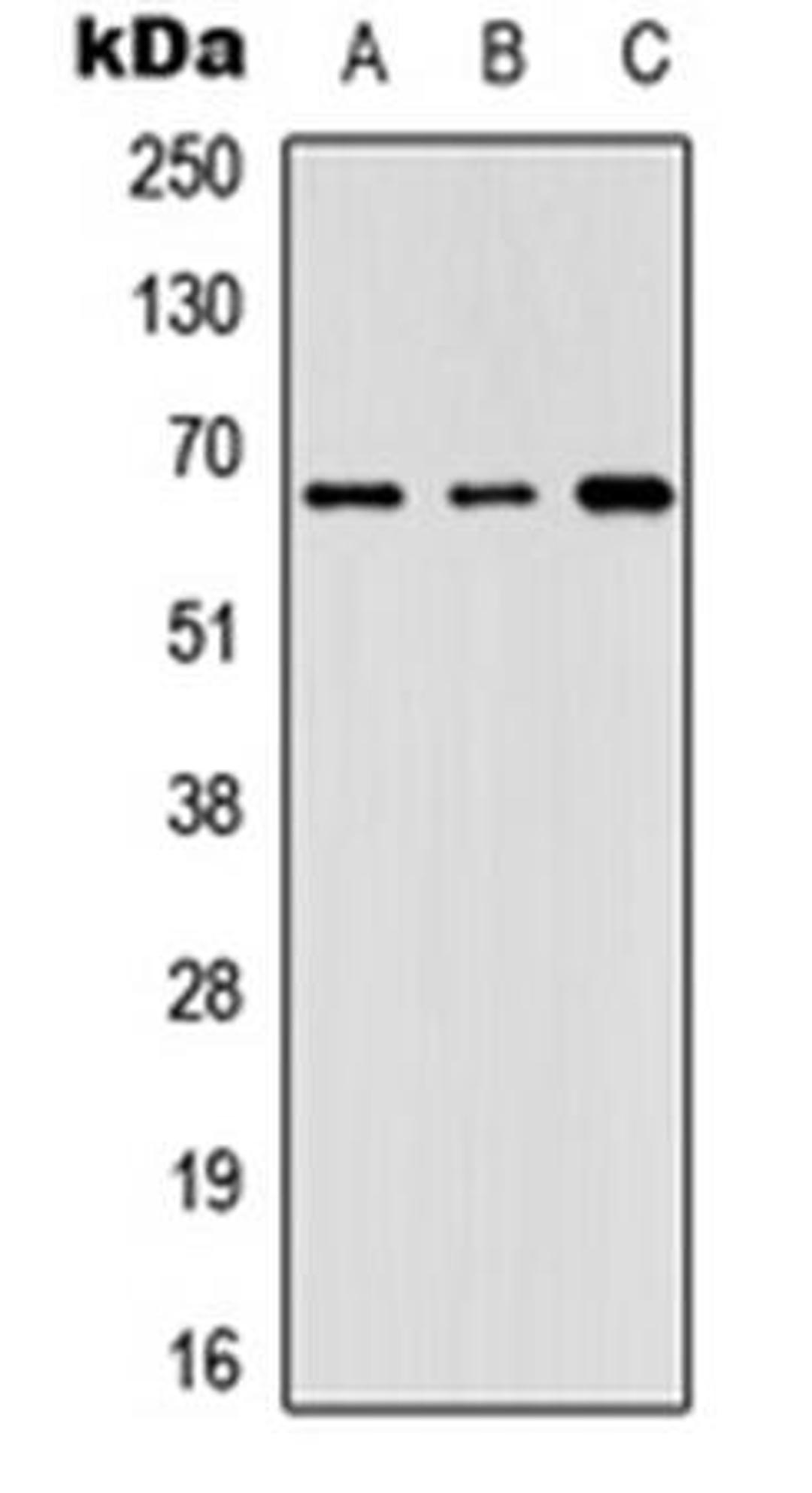 Western blot analysis of Lovo (Lane1), HeLa (Lane2), NIH3T3 (Lane3) whole cell using GNL3L antibody