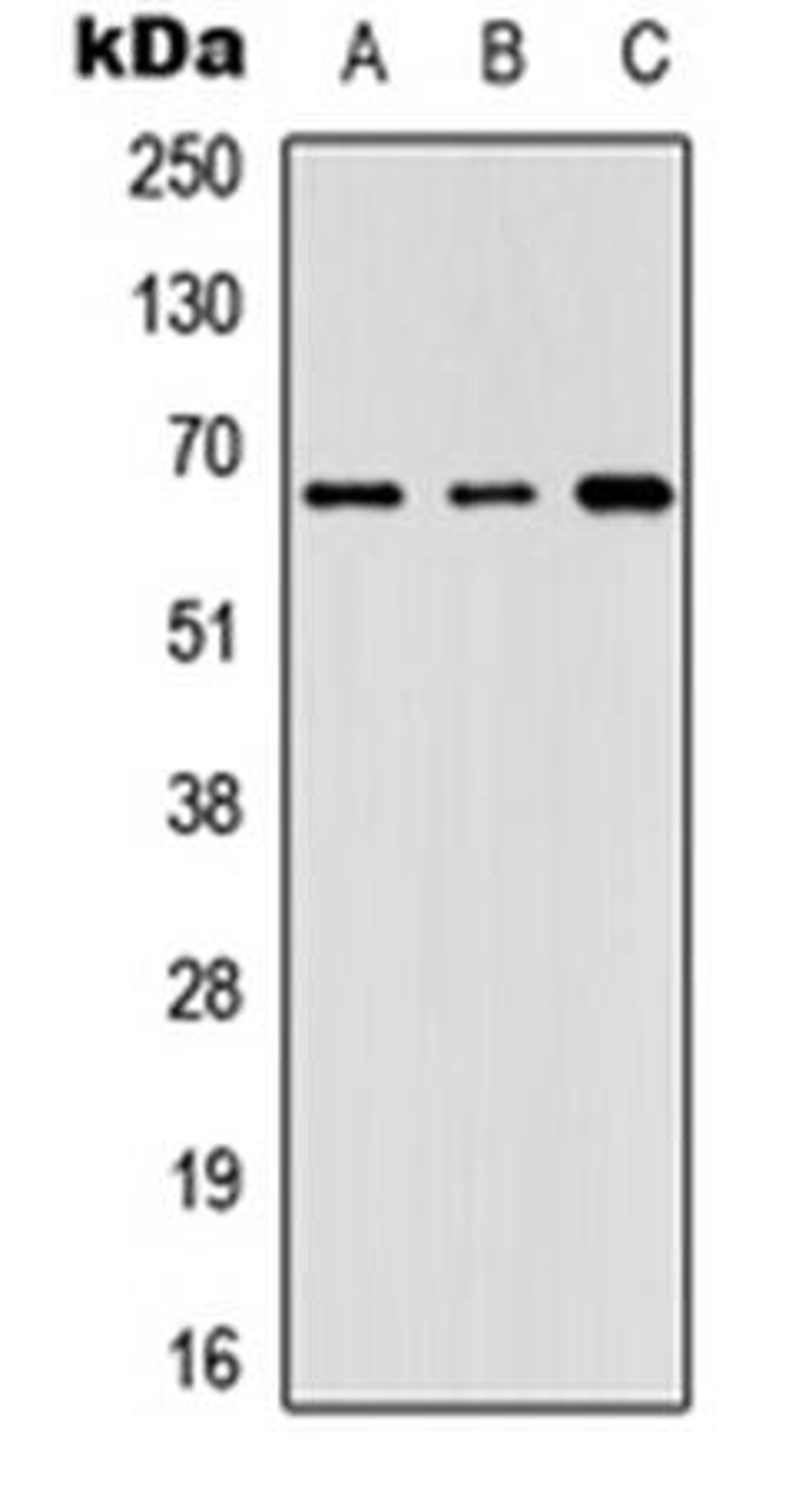 Western blot analysis of Lovo (Lane1), HeLa (Lane2), NIH3T3 (Lane3) whole cell using GNL3L antibody