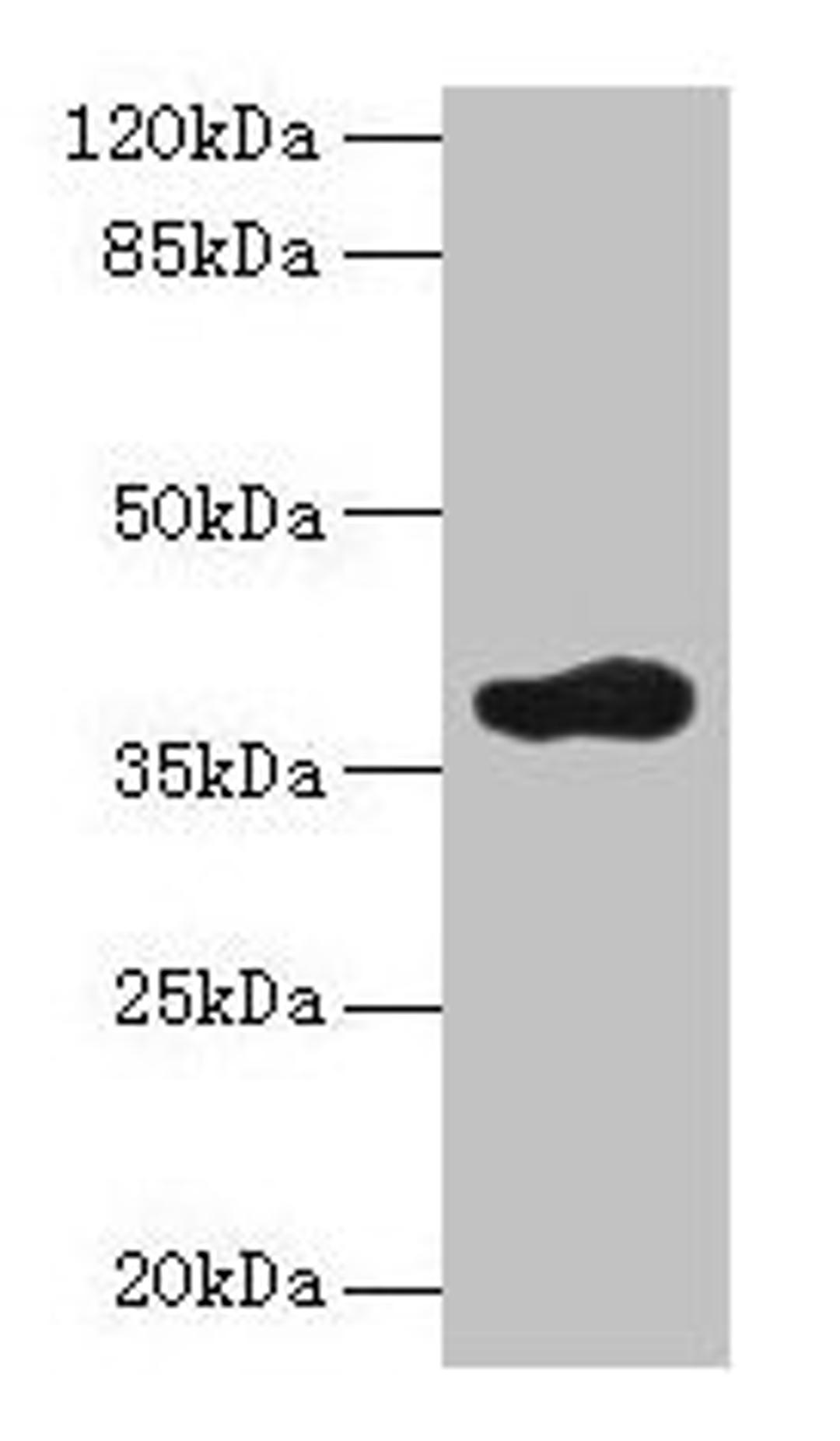 Western blot. All lanes: ARFIP2 antibody at 2µg/ml + Mouse brain tissue. Secondary. Goat polyclonal to rabbit IgG at 1/10000 dilution. Predicted band size: 38, 30, 34 kDa. Observed band size: 38 kDa