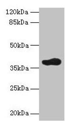 Western blot. All lanes: ARFIP2 antibody at 2µg/ml + Mouse brain tissue. Secondary. Goat polyclonal to rabbit IgG at 1/10000 dilution. Predicted band size: 38, 30, 34 kDa. Observed band size: 38 kDa