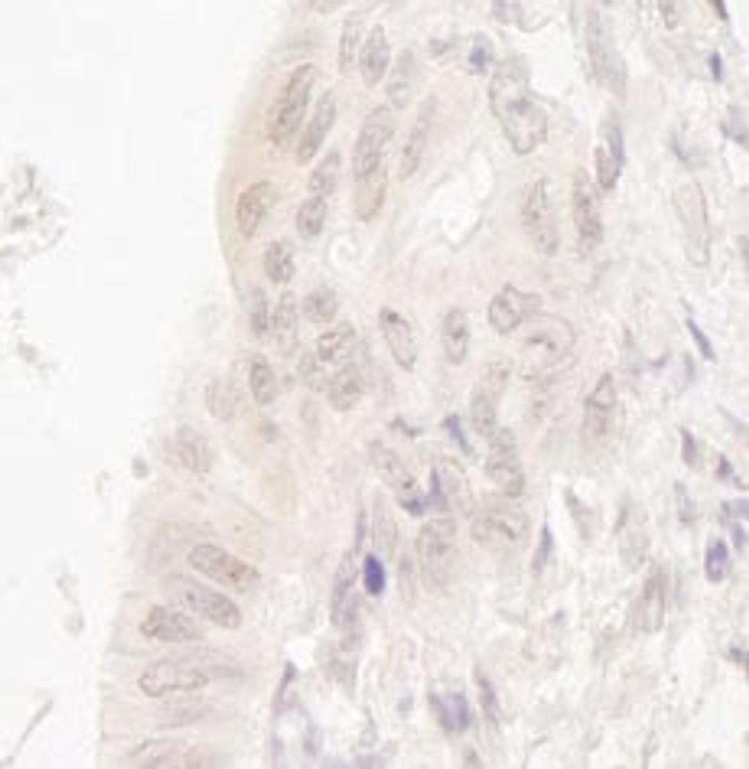 Detection of human CASC5 by immunohistochemistry.