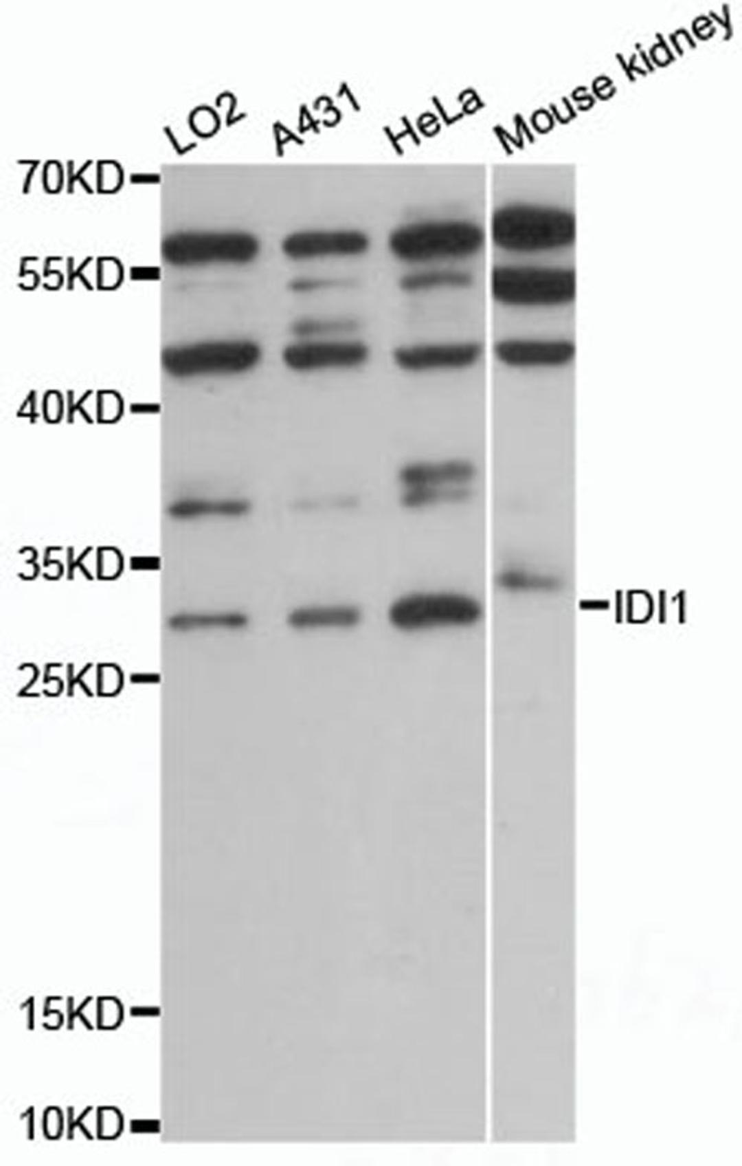 Western blot - IDI1 antibody (A13826)