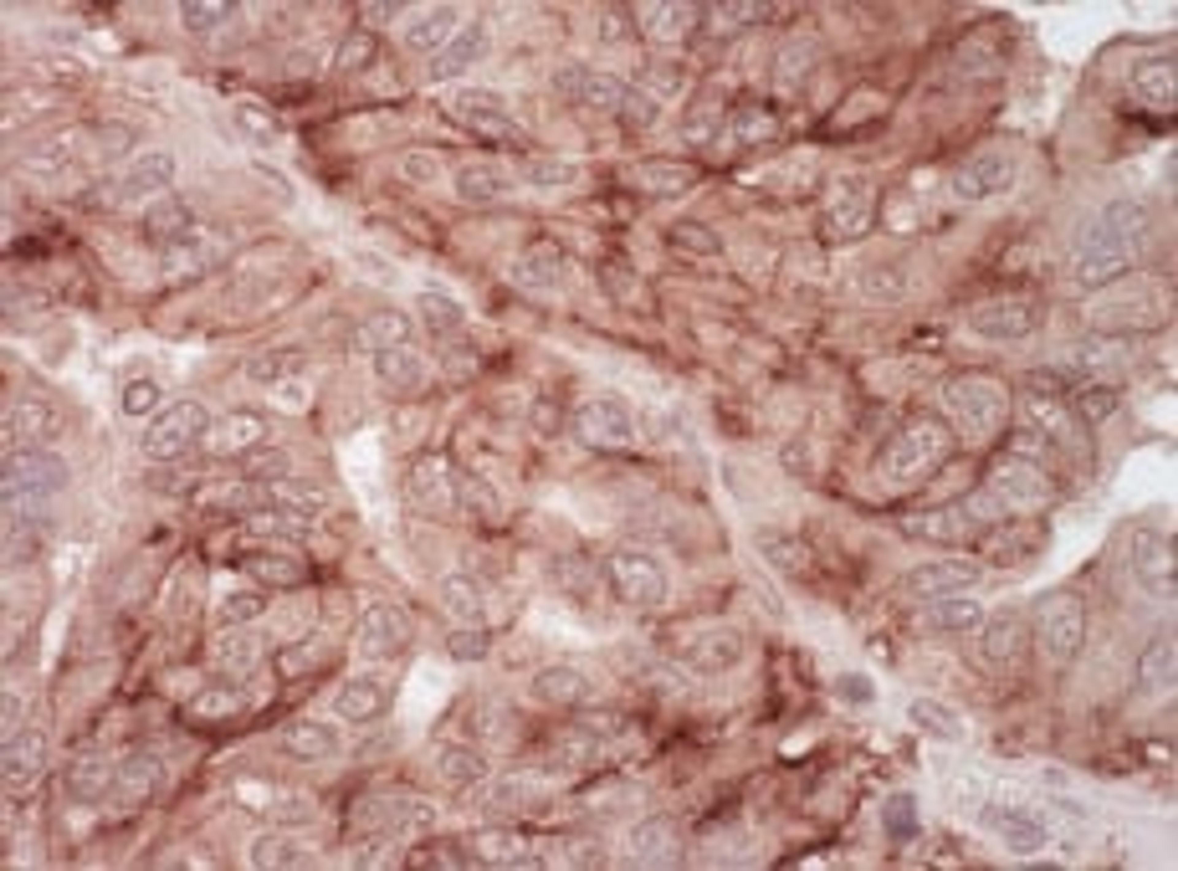 Detection of human CAR by immunohistochemistry.