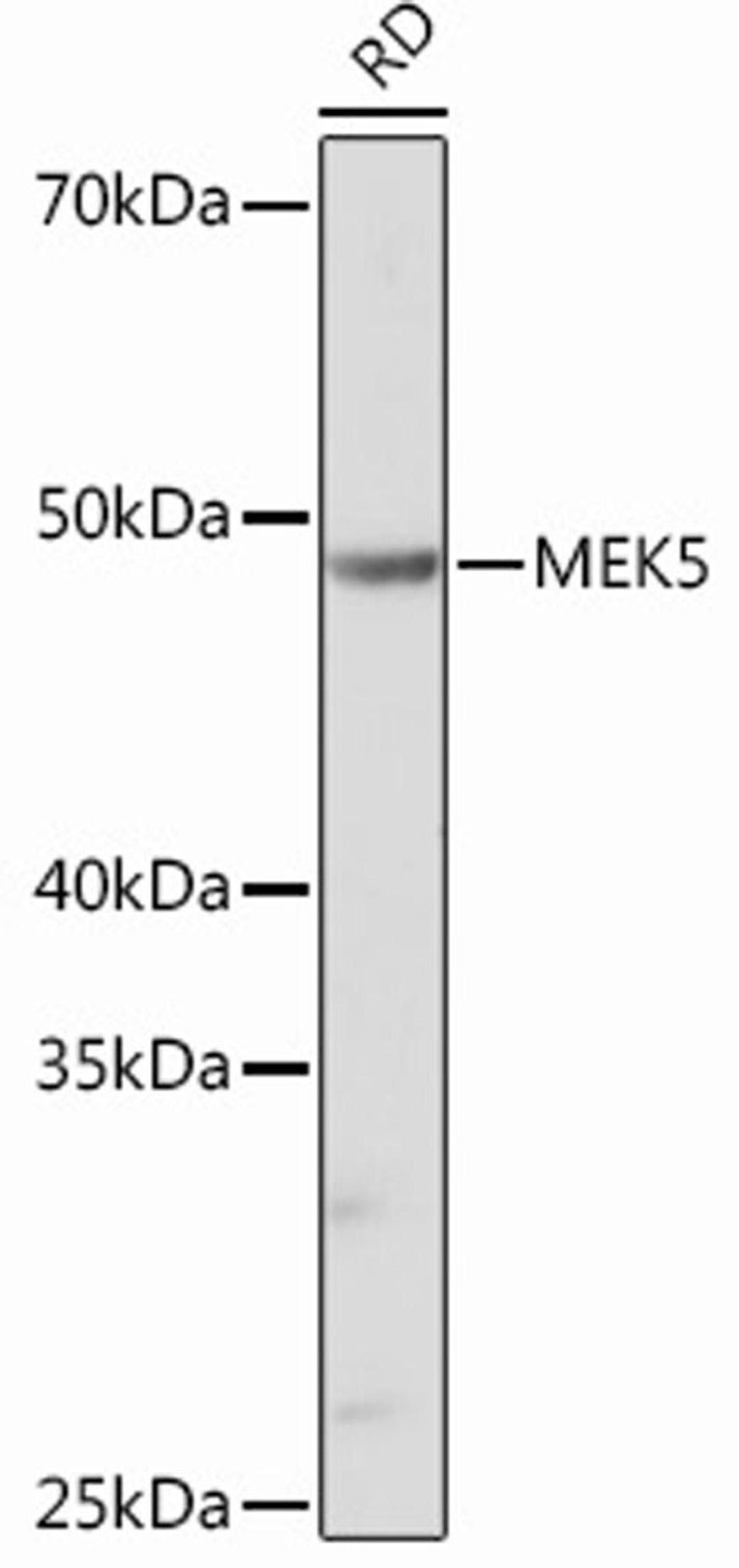 Western blot - MEK5 Rabbit mAb (A12457)