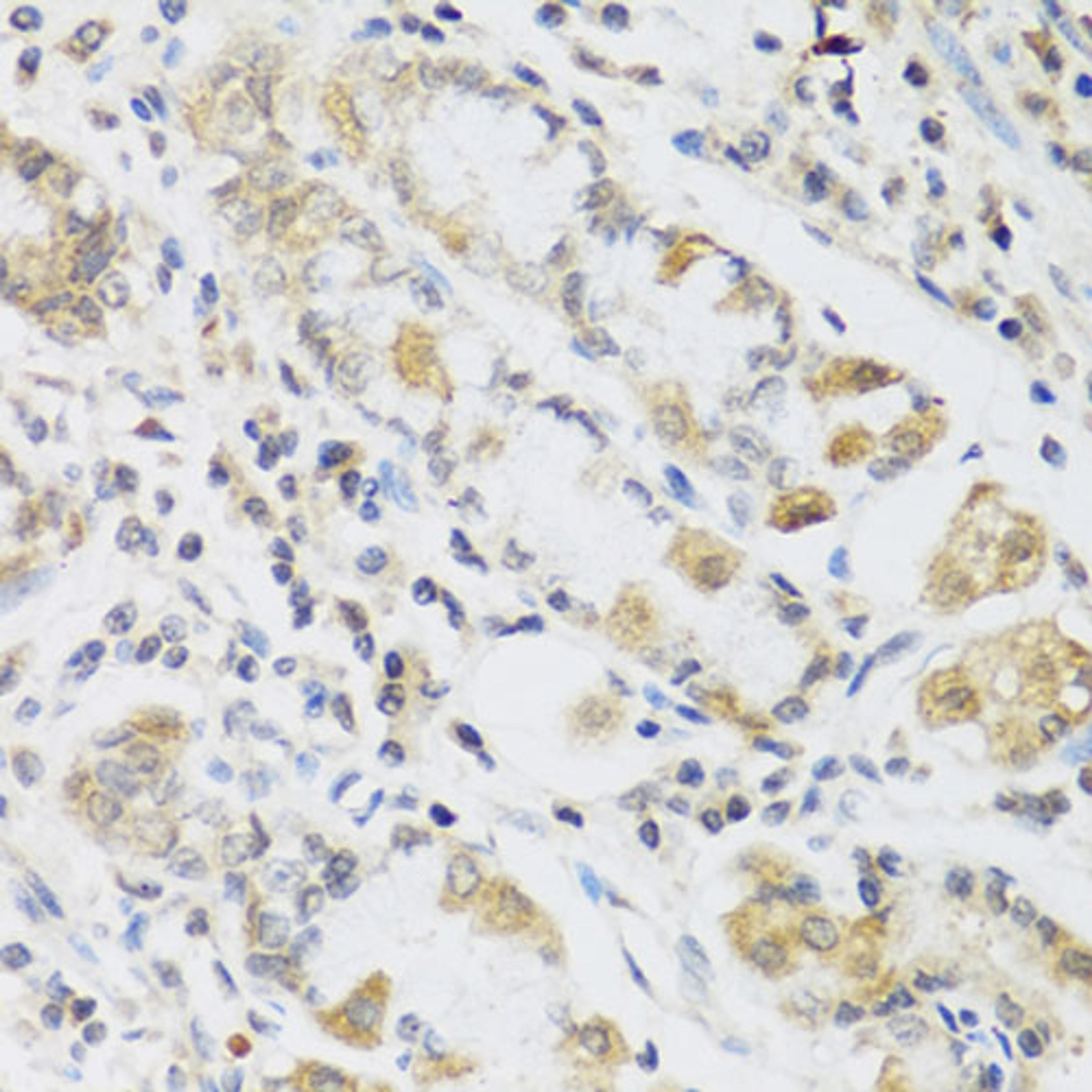 Immunohistochemistry  - RETN antibody (A2551)