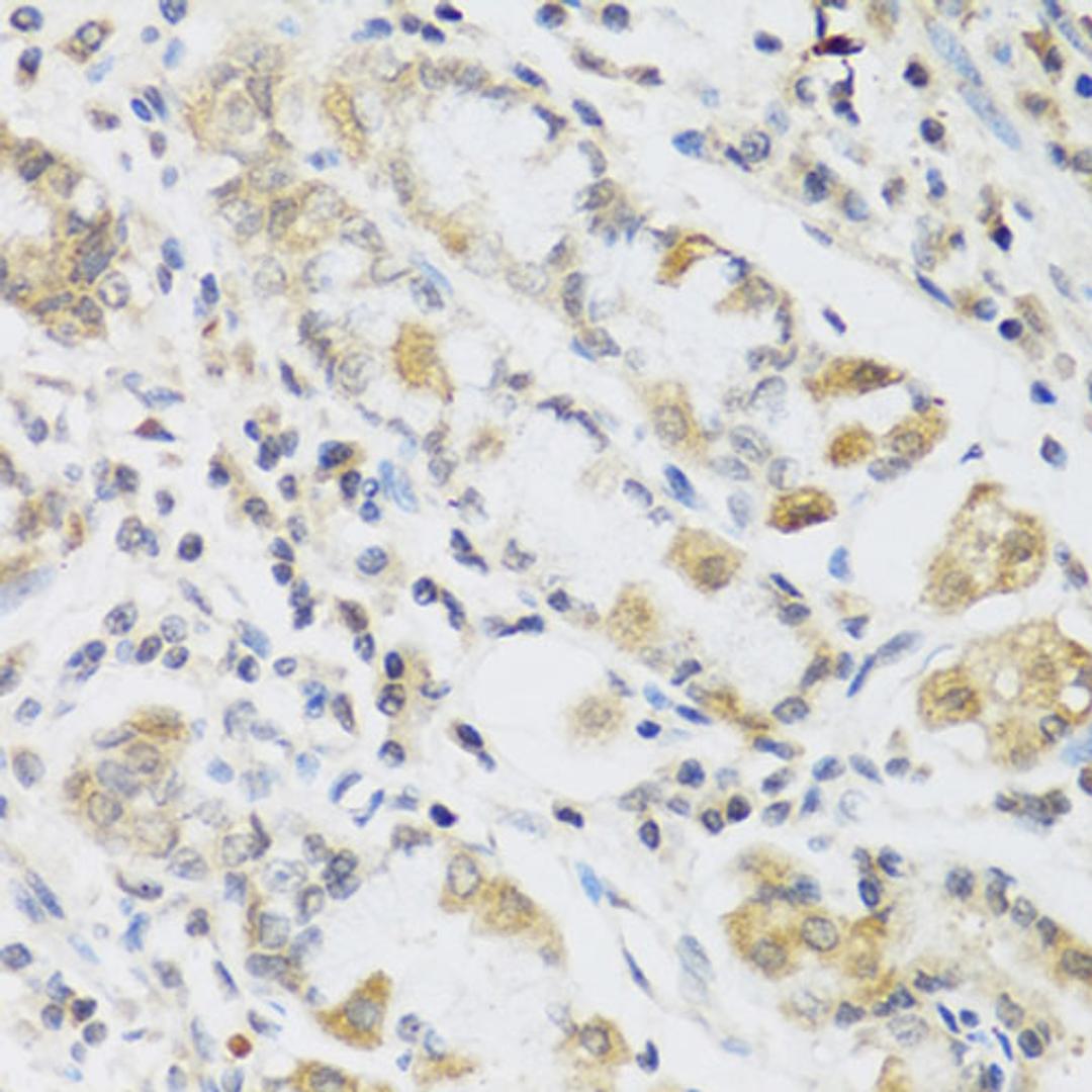 Immunohistochemistry - RETN antibody (A2551)