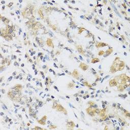 Immunohistochemistry - RETN antibody (A2551)