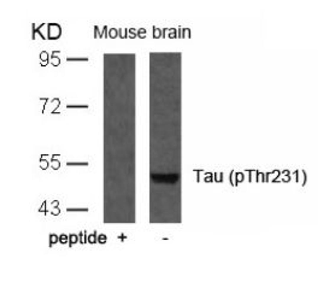 Western blot analysis of lysed extracts from mouse brain tissue using Tau (Phospho-Thr231).