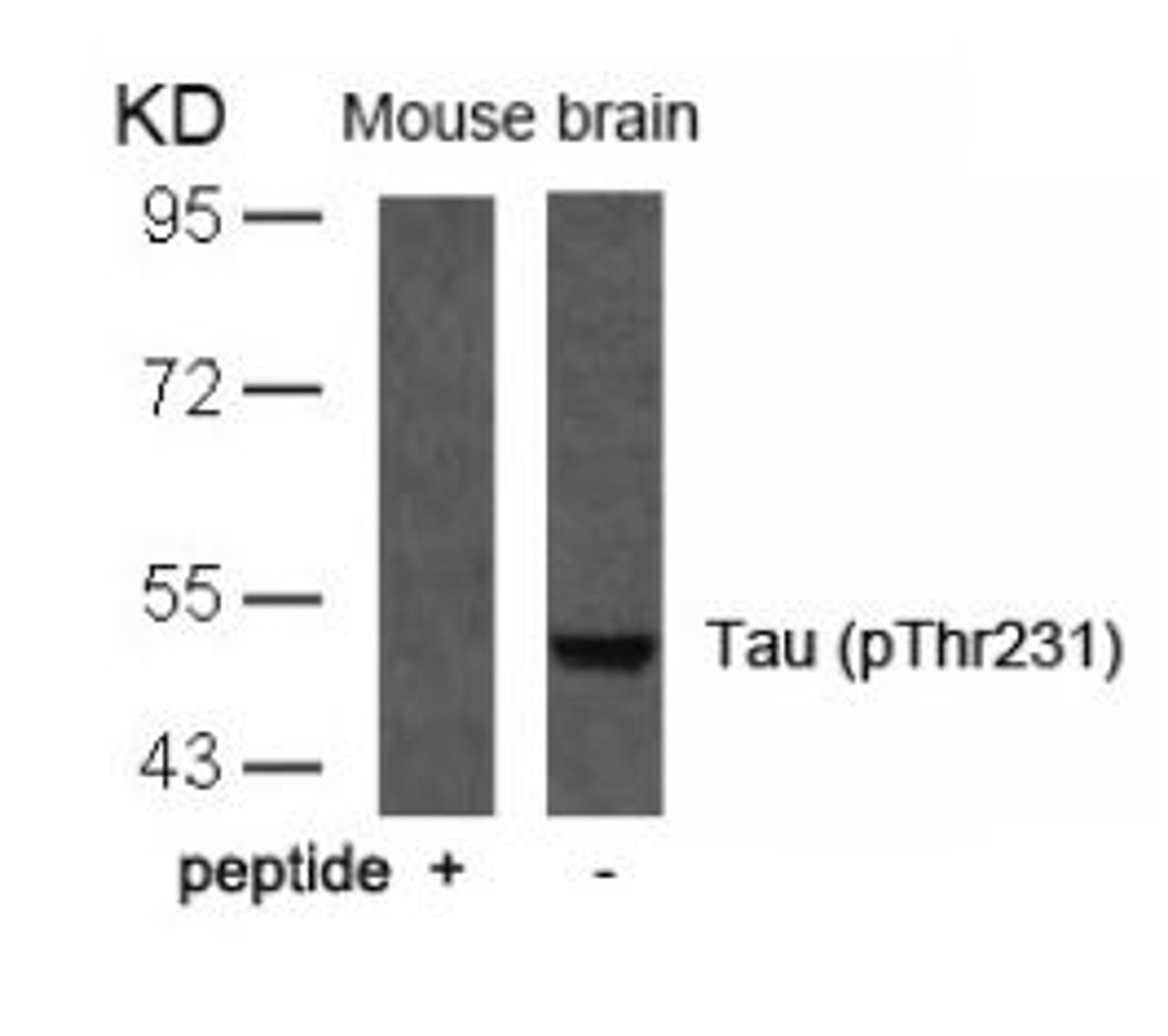 Western blot analysis of lysed extracts from mouse brain tissue using Tau (Phospho-Thr231).