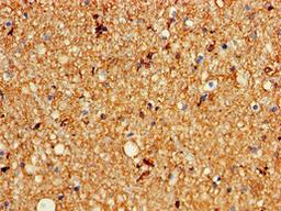 Immunohistochemistry of paraffin-embedded human brain tissue using CSB-PA012018LA01HU at dilution of 1:100