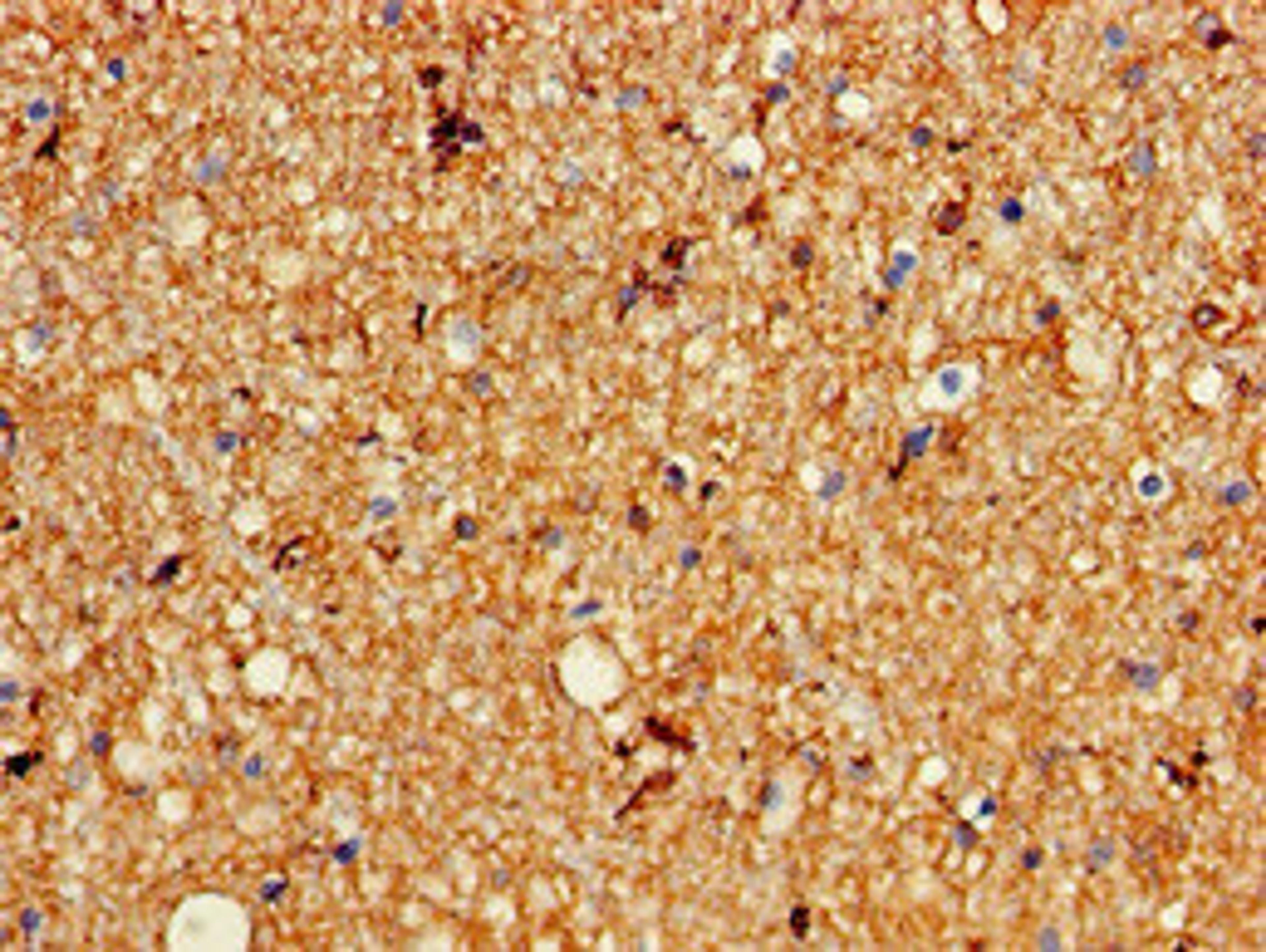 Immunohistochemistry of paraffin-embedded human brain tissue using CSB-PA012018LA01HU at dilution of 1:100