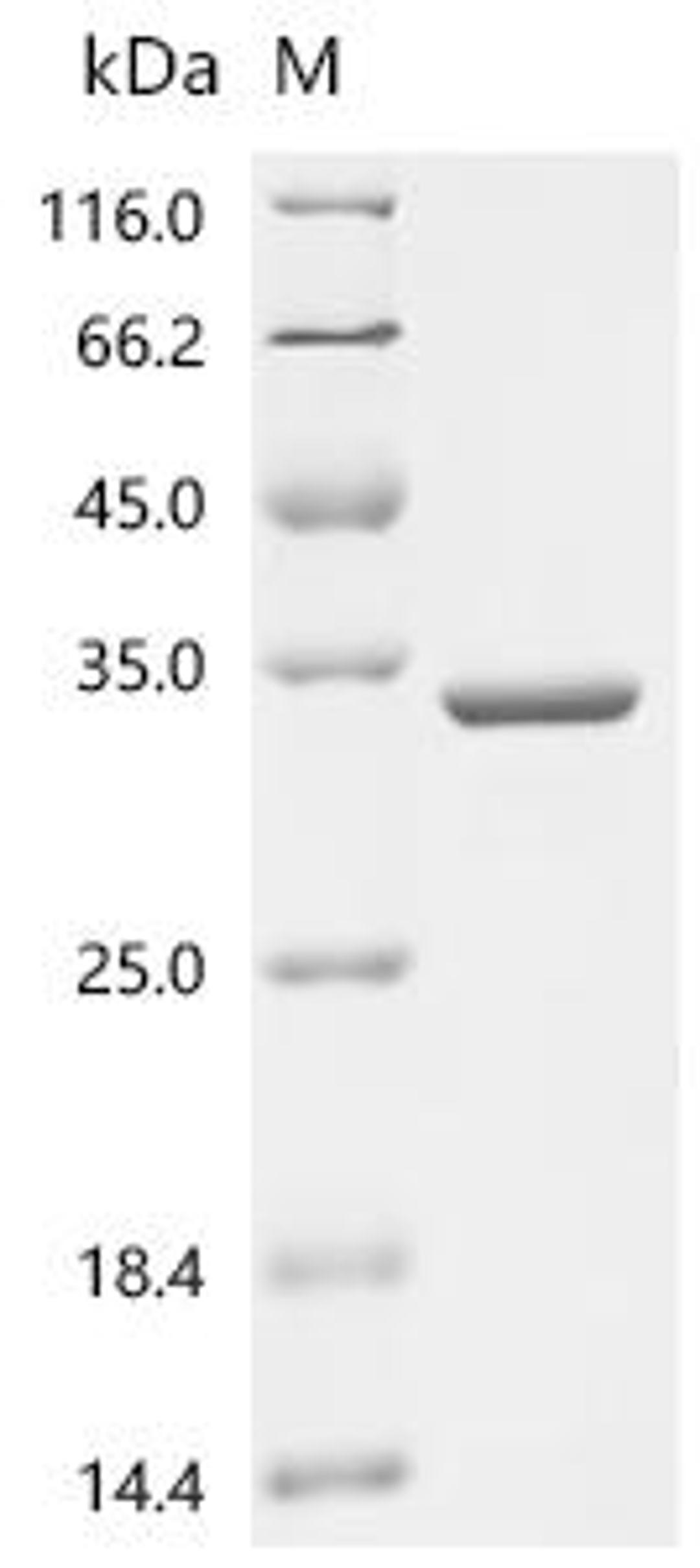 (Tris-Glycine gel) Discontinuous SDS-PAGE (reduced) with 5% enrichment gel and 15% separation gel.