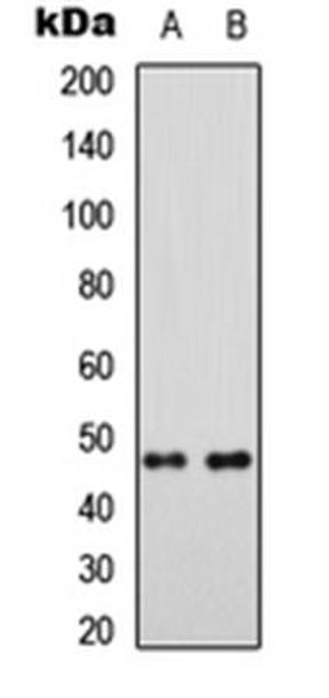 Western blot analysis of HEK293T (Lane1), Raw264.7 (Lane2) whole cell using MRPS5 antibody