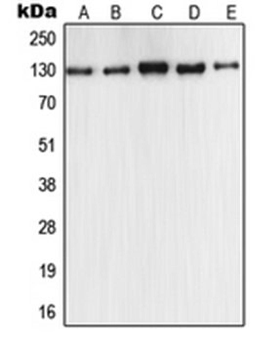 Western blot analysis of MCF7 (Lane 1), A549 (Lane 2), Raw264.7 (Lane 3), PC12 (Lane 4), rat liver (Lane 5) whole cell lysates using NOS2 antibody