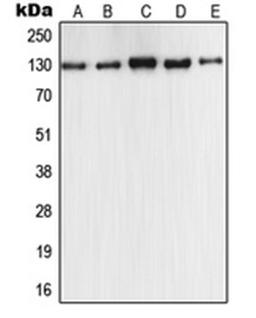 Western blot analysis of MCF7 (Lane 1), A549 (Lane 2), Raw264.7 (Lane 3), PC12 (Lane 4), rat liver (Lane 5) whole cell lysates using NOS2 antibody