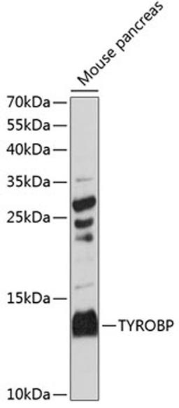 Western blot - TYROBP antibody (A14794)